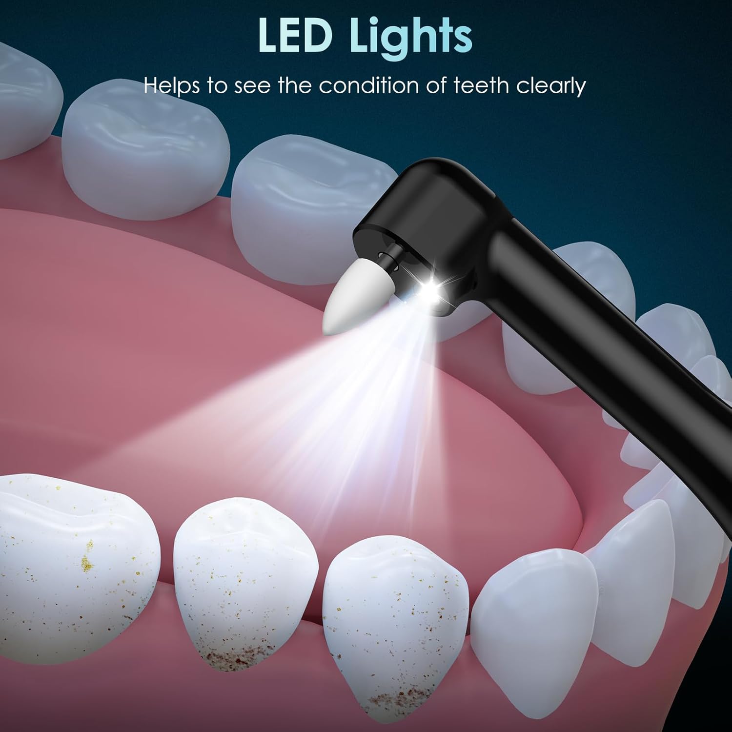 Pulidor de dientes Pulidor de  - Teeth Whitening Or Tooth Whitening reseña y precio