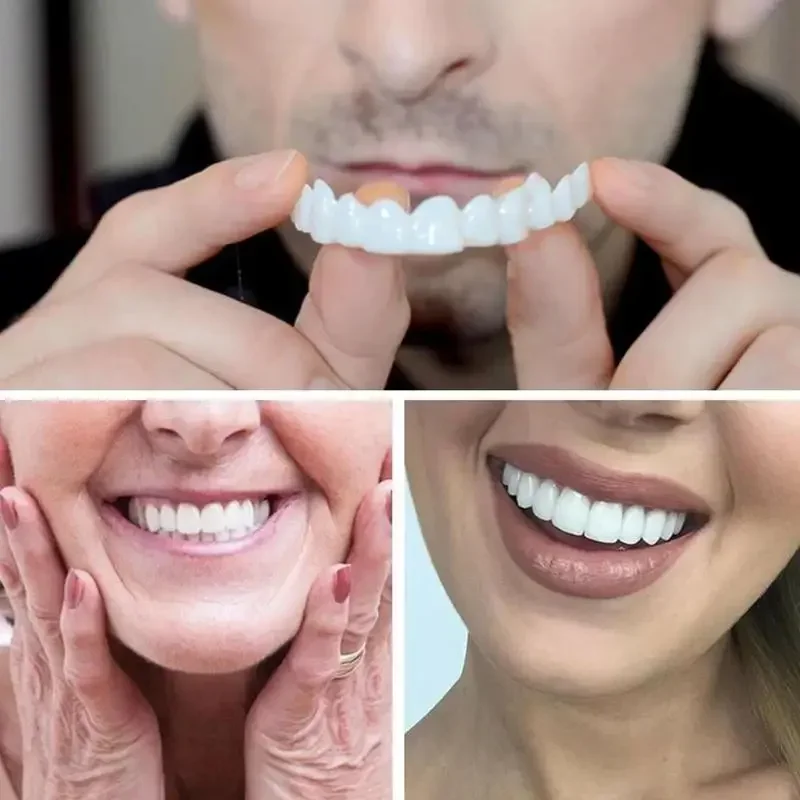 Carillas dentales Charming Smi - Teeth Whitening Uneven reseña y precio