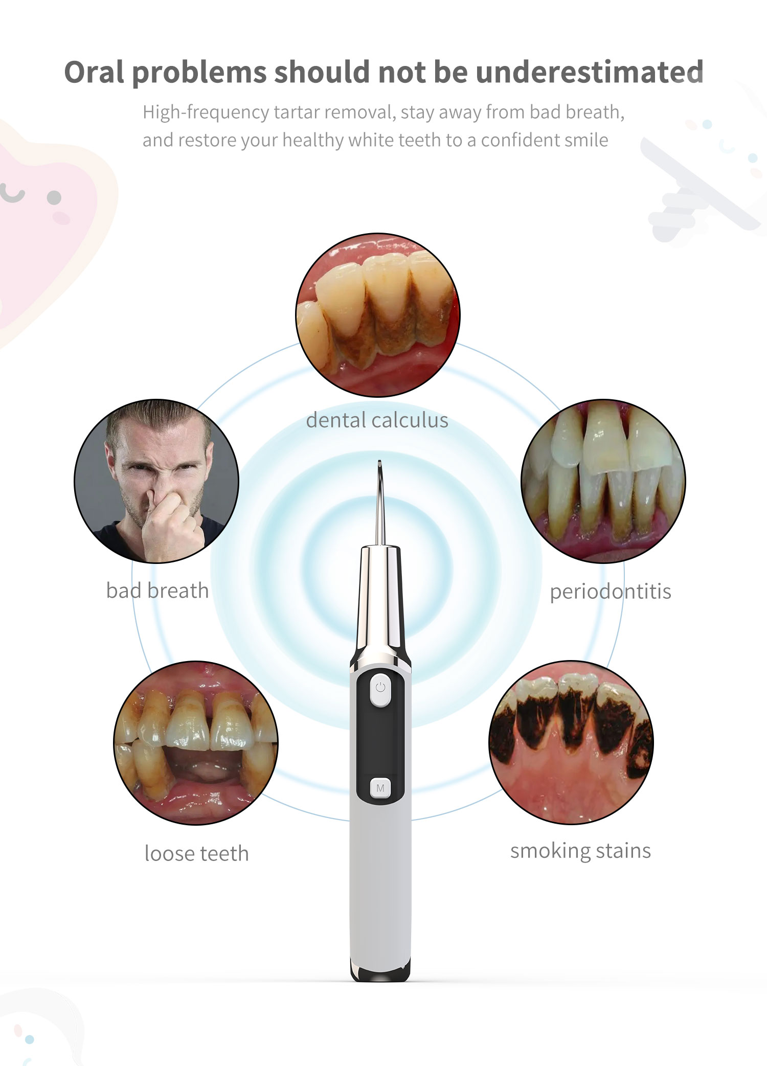 Escalador de cálculo Dental só - Teeth Whitening Or Tooth Whitening reseña y precio