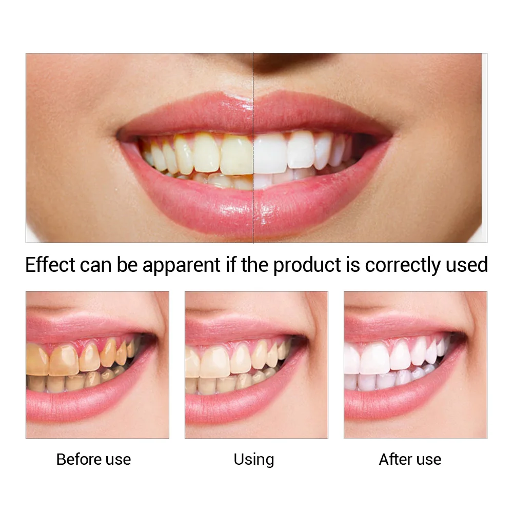 FTEENPLY-esencia para blanquea - Teeth Whitening Ulta reseña y precio