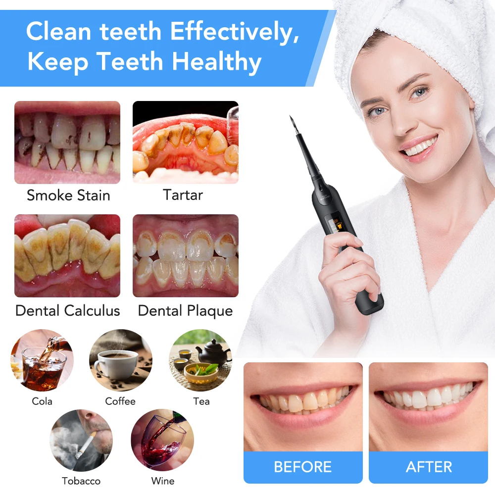 Escalador Dental eléctrico, ju - Teeth Whitening Or Tooth Whitening reseña y precio