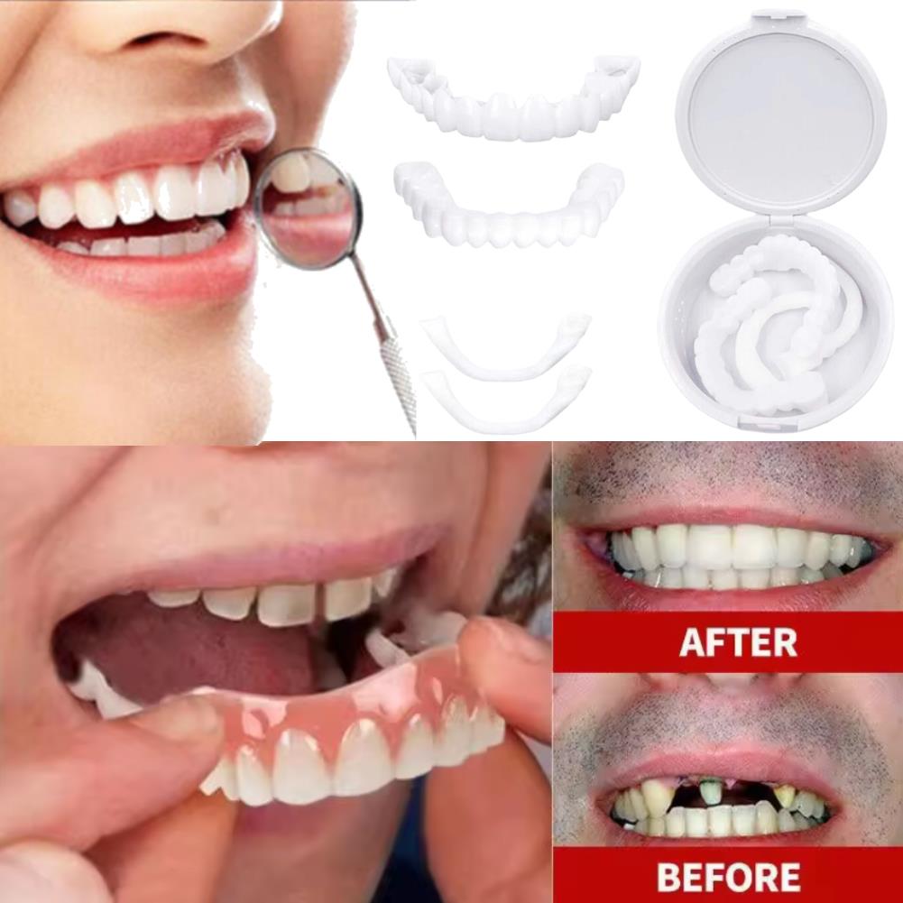 Nuevas carillas dentales New C - Teeth Whitening Uneven reseña y precio