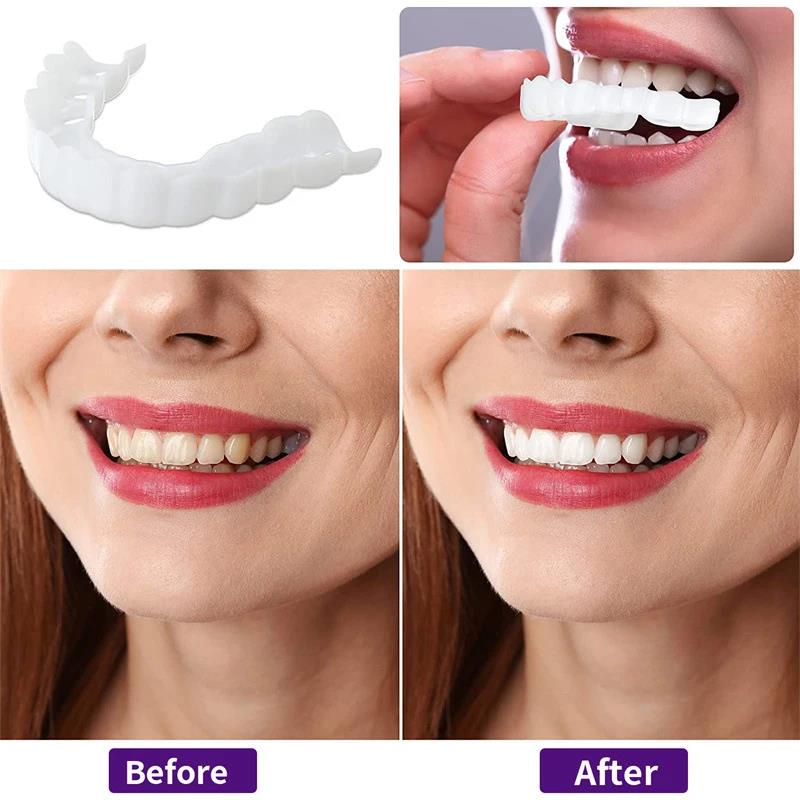 Nuevas carillas dentales para  - Teeth Whitening Uneven reseña y precio
