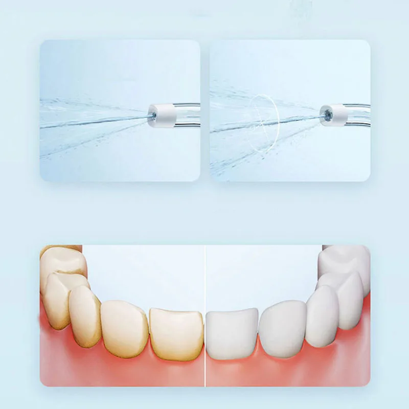 Irrigador Bucal Portátil Xiaom - Teeth Whitening Or Tooth Whitening reseña y precio