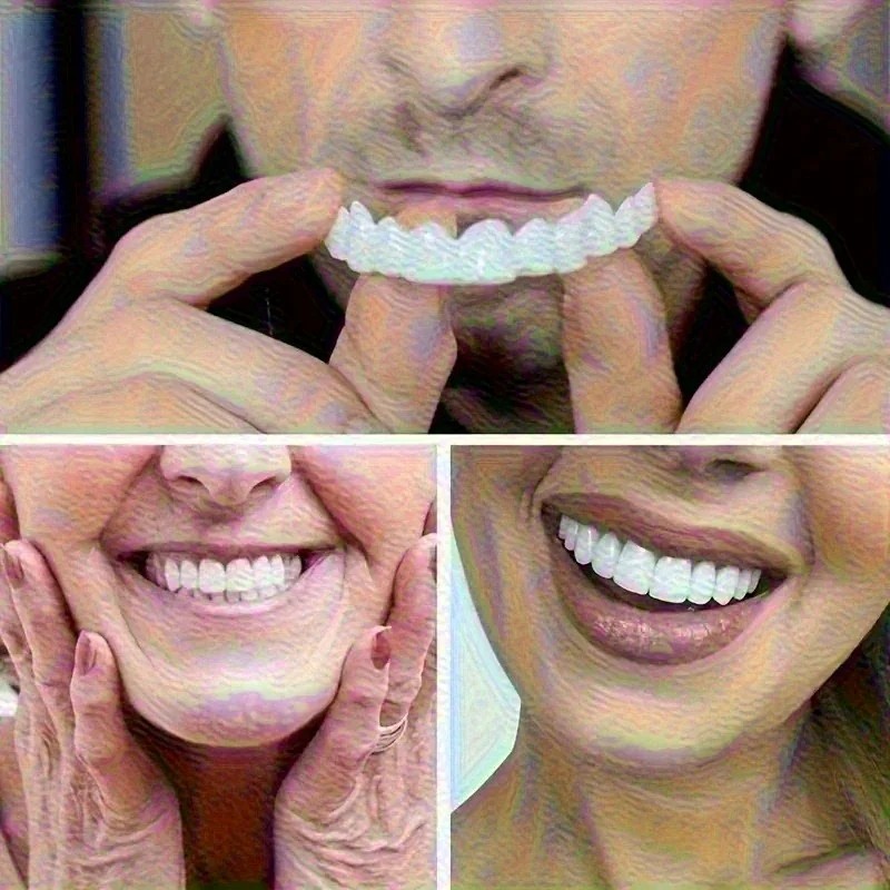 Nuevas Carillas Dentales Reuti - Teeth Whitening Uneven reseña y precio