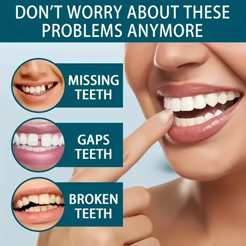 Nuevas Carillas Dentales Reuti - Teeth Whitening Uneven reseña y precio