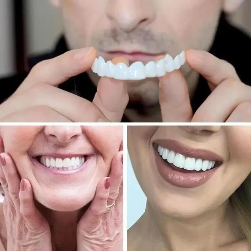 Nuevas carillas dentales New C - Teeth Whitening Uneven reseña y precio