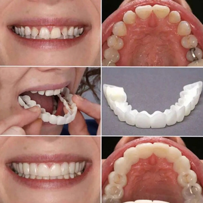 Nuevas carillas dentales tempo - Teeth Whitening Uneven reseña y precio