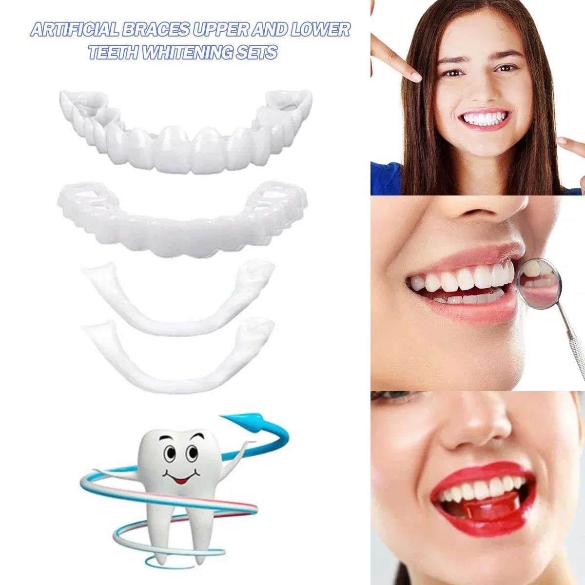 Nuevas carillas dentales tempo - Teeth Whitening Uneven reseña y precio
